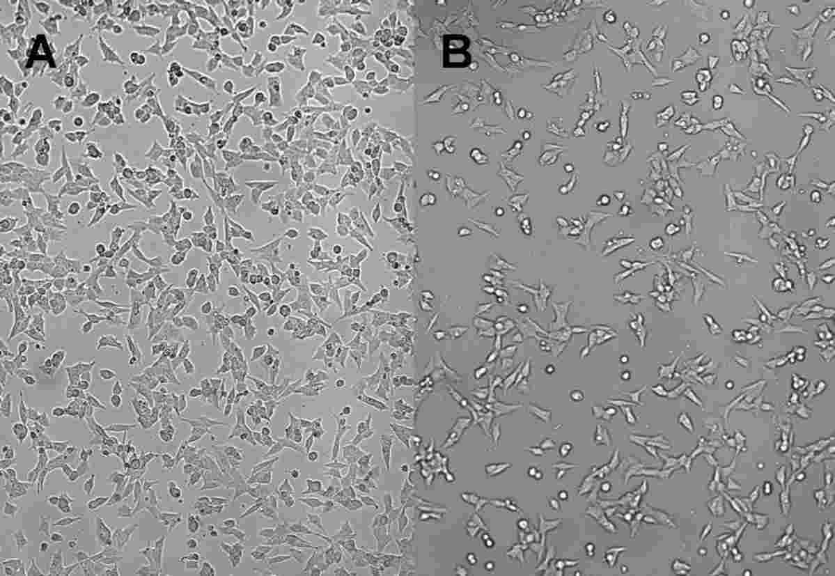 Siringa siringa da 150 ml siringa in plastica grande per laboratori  scientifici su sfondo bianco vista dall'alto